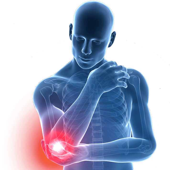 artroza gležnja nakon liječenja prijeloma bol tijekom napora u lakatnom zglobu